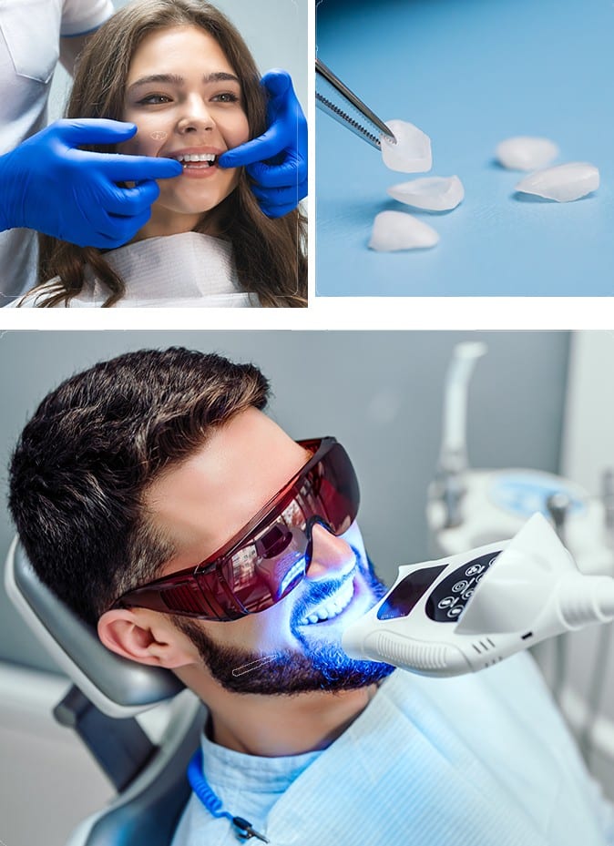 Cosmetic Dentistry Toronto | Teeth whitening, veneers, and crowns