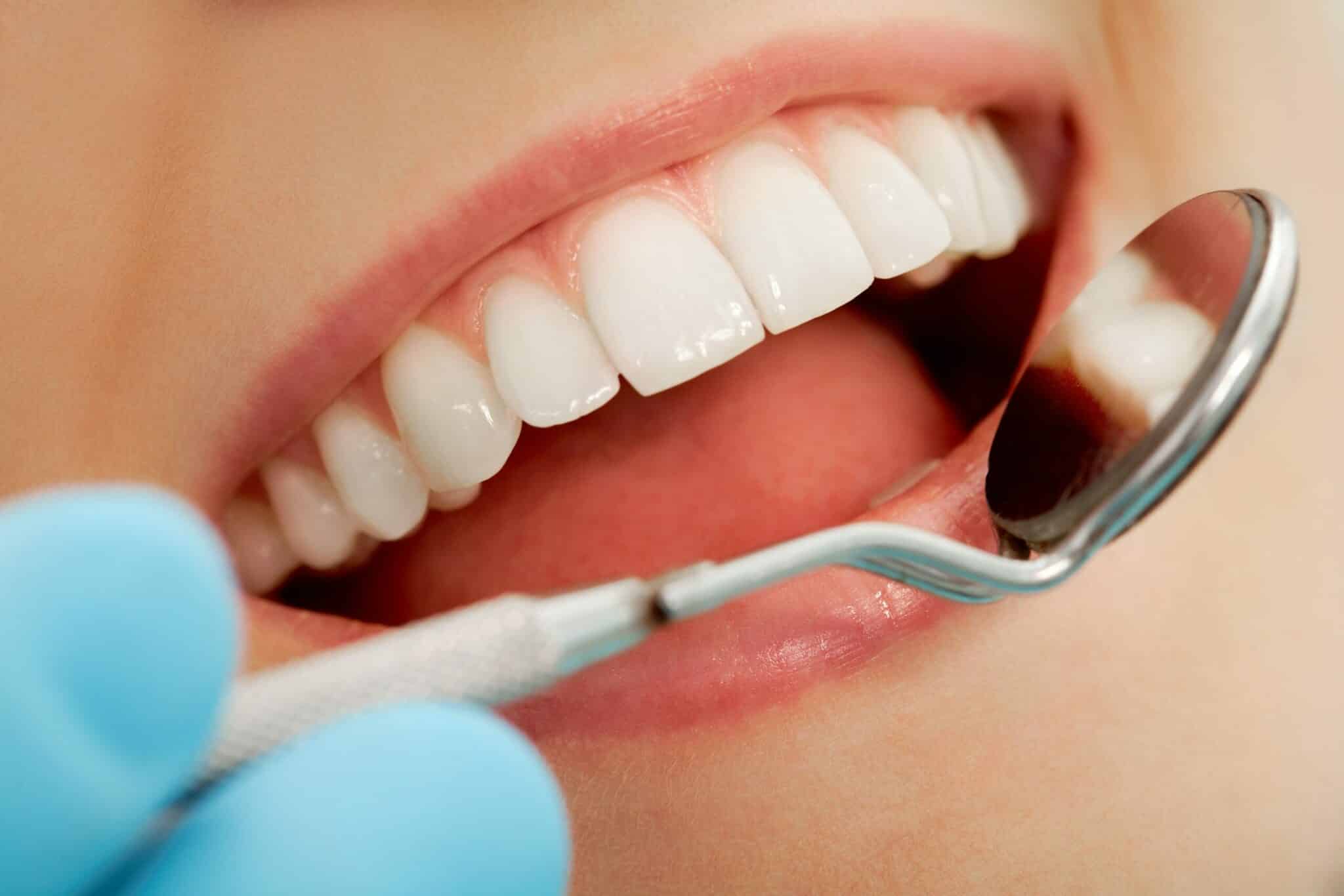 Oral Health - Toronto Smile Centre