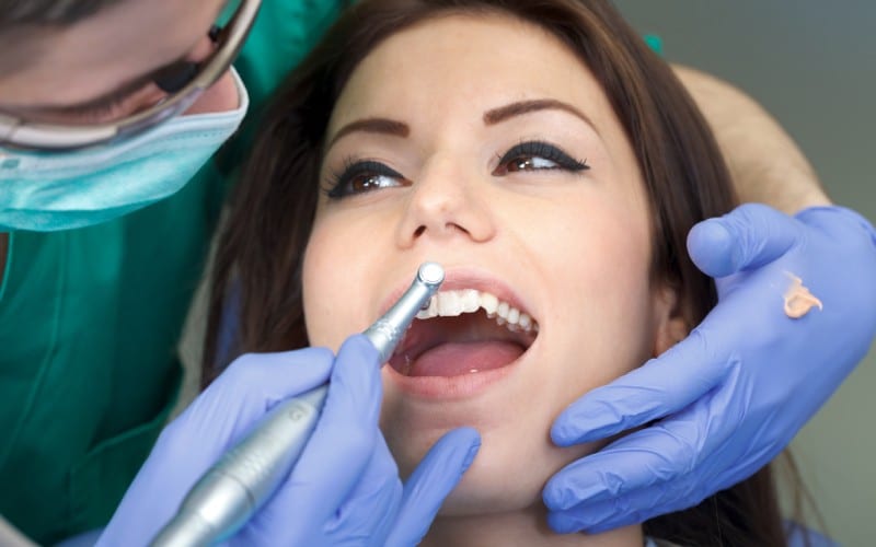 Polishing-Dentist teeth cleaning